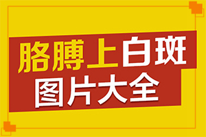 治療白斑的土方法(輔助恢復)白點癲風可以治療好嗎