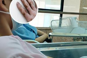 十幾歲小男孩臉上有色素脫失癥怎么回事