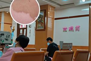 母親白癜風會傳染嗎下一代會遺傳嗎