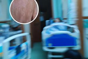 光療311進口有嗎是真的嗎