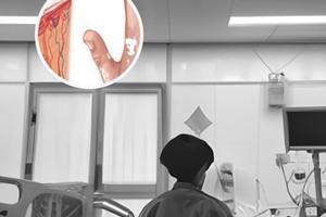 白癜風(fēng)暈痣是什么