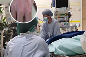 胳膊上有色素脫失癥那屬于什么能不能治好