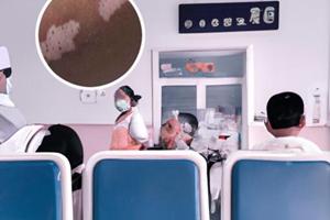 白癜風照308又復發了怎么回事