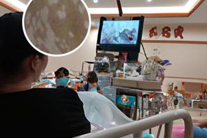 復方白斑膏白斑能擦嗎