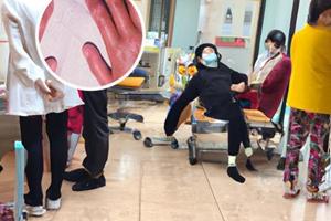 小孩肚子上有白斑原因圖片大全圖解