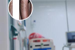 潑尼松片圖片怎么樣的