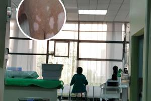 鄭州白斑十佳醫(yī)院名單圖片