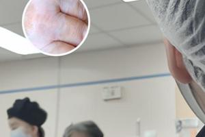 308準激光治療白斑原理是啥樣的