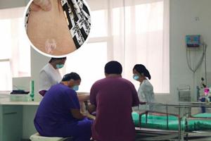 鄭州西京醫(yī)院專家會診中心電話