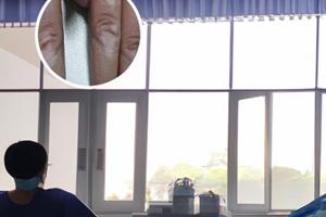 他克莫司品牌不一樣