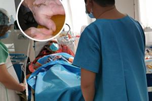 身上長了個暈痣代表什么意思