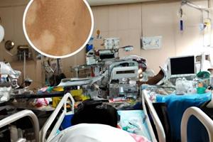 河南省治白癜風(fēng)最好的醫(yī)院是哪個醫(yī)院