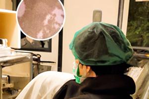 白癜風遺傳多大發(fā)病