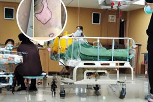 開封中醫(yī)看白癜風(fēng)怎么樣