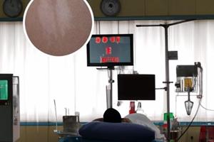 白癜風病不能吃哪些東西