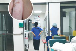 白癜風會突然出現(xiàn)嗎