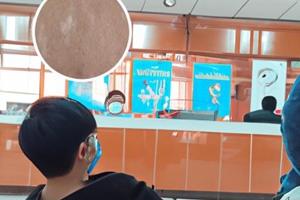 祛斑后色素減退疤痕能恢復(fù)嗎知乎