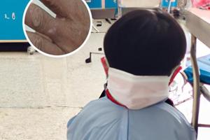 白癜風(fēng)光療多久才有效果